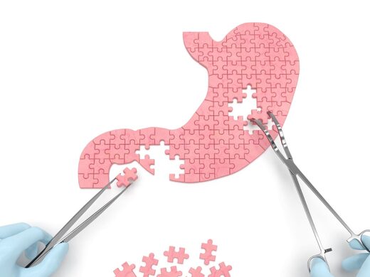 Est-il&#x20;possible&#x20;de&#x20;suivre&#x20;le&#x20;Programme&#x20;RNPC&#x20;apr&#x00E8;s&#x20;une&#x20;chirurgie&#x20;bariatrique&#x20;&#x3F;